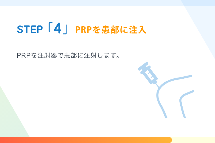 STEP4 PRPを患部に注入 | PRPを注射器で患部に注射します。