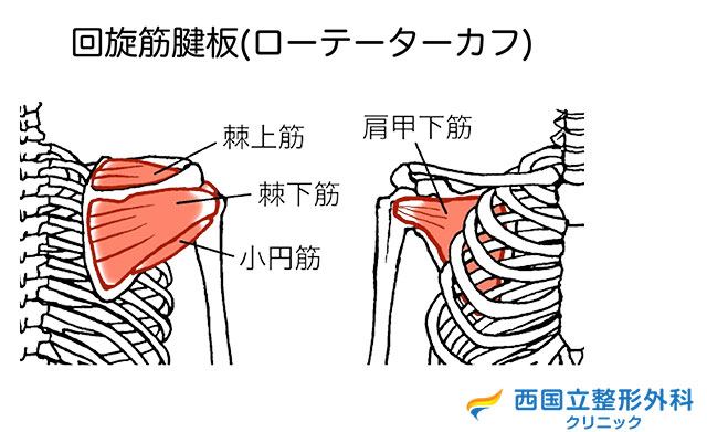 腱板断裂について